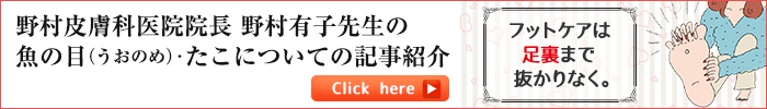 皮膚科専門医による、魚の目（うおのめ）たこについての記事をご紹介