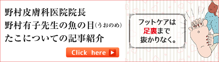 皮膚科専門医による、魚の目（うおのめ）たこについての記事をご紹介