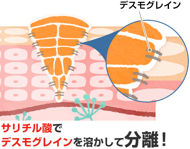 サリチル酸でデスモグレインを溶かして分離！